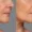 Skin Quality Medellín- Clínica Be Dharma