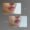 Antes y después Aumento de labios en Medellín - Centro Estético Be Dharma