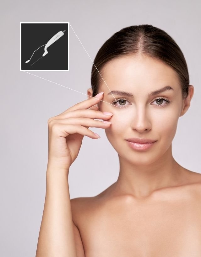 AccuTite radiofrequency procedure in Medellín at Be Dharma
