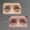 Eliminación de ojeras antes y después - Clínica estética Be Dharma Medellín