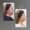 Sculptra antes y después en Medellín - Clínica estética Be Dharma 2