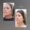 Sculptra antes y después en Medellín - Clínica estética Be Dharma 3