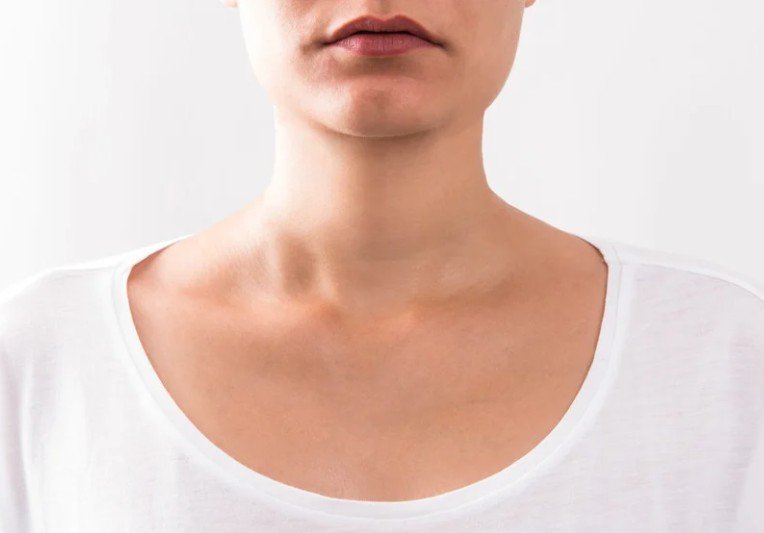 Sculptra en cuello - Clínica estética Be Dharma