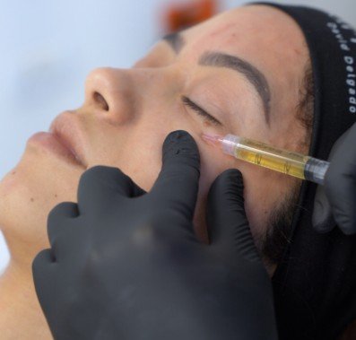 Tipos de ácido hialurónico en ojeras - Clínica estética Be Dharma de Medellín