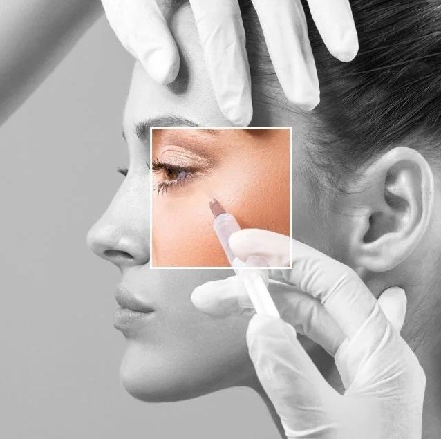 Botulinum toxin in Medellín - Be Dharma Aesthetic clinic