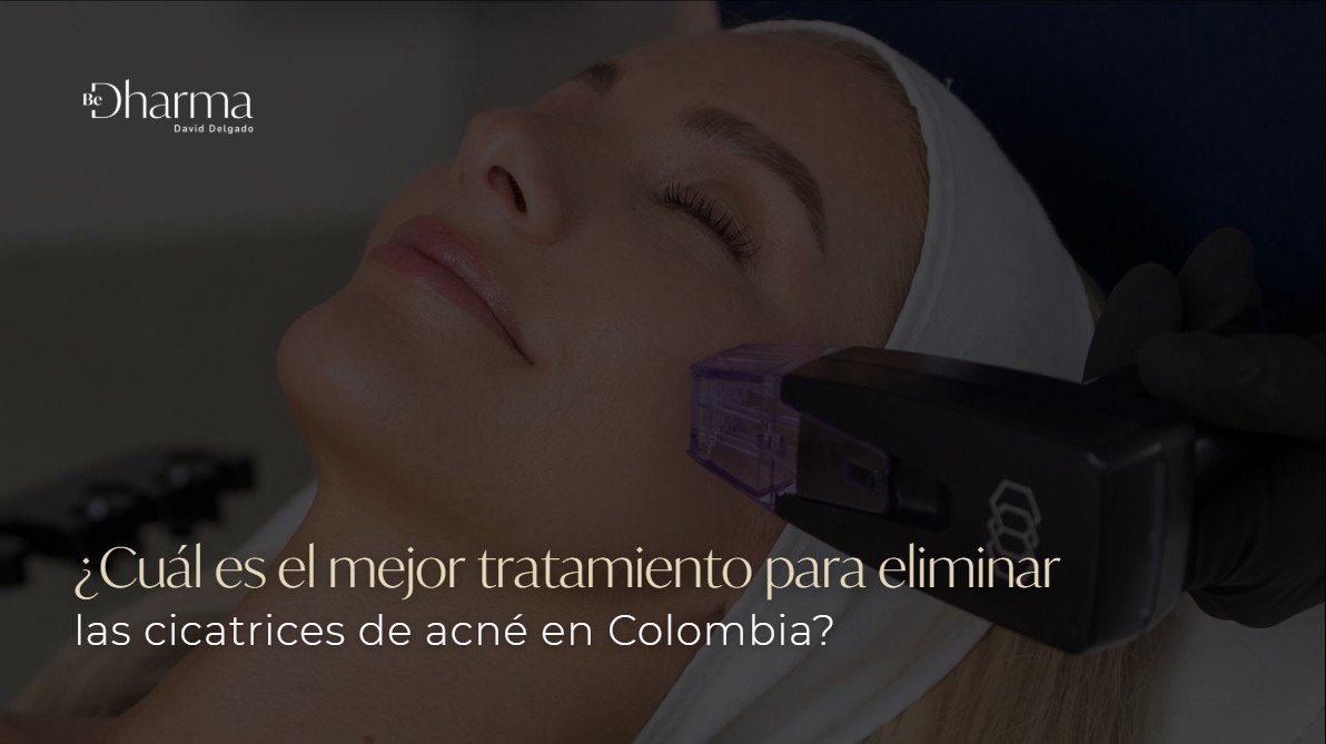Cicatrices de acné eliminar- Clínica Be Dharma