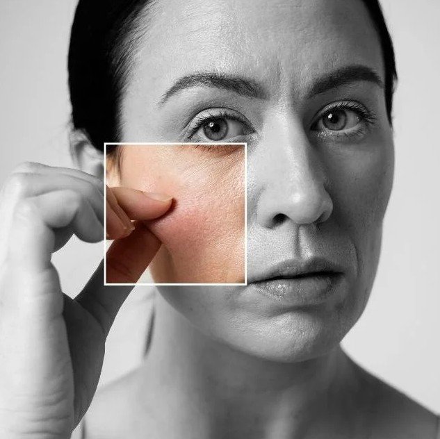 Collagen bioestimulators in Medellín - Be Dharma Aesthetic clinic