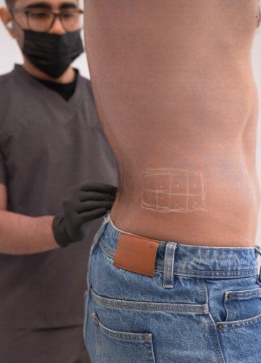 Tratamientos para eliminar grasa sin cirugía en 2026 - Clínica be Dharma de Medellín - enzimas biocombinantes