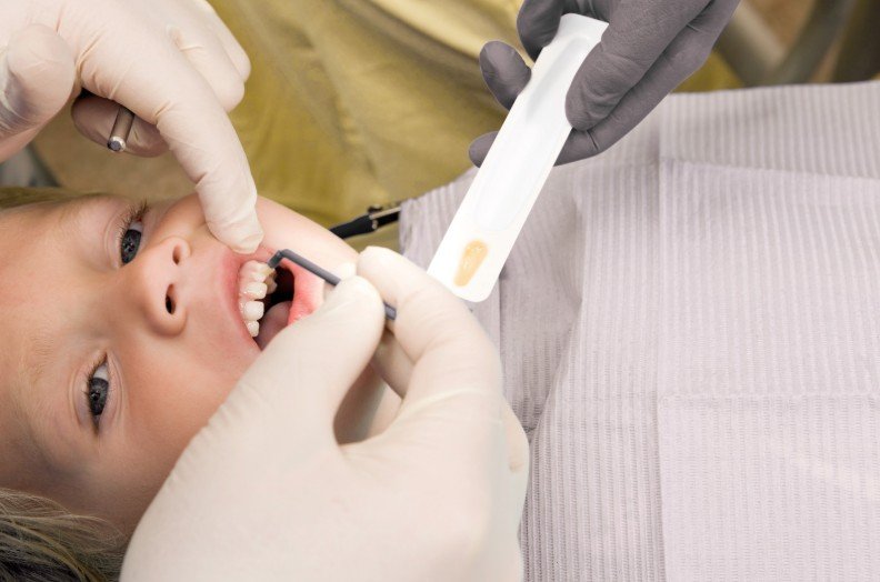 Aplicación de flúor en Medellín - Centro de odontología estética Be Dharma Dental - Clínica Be Dharma