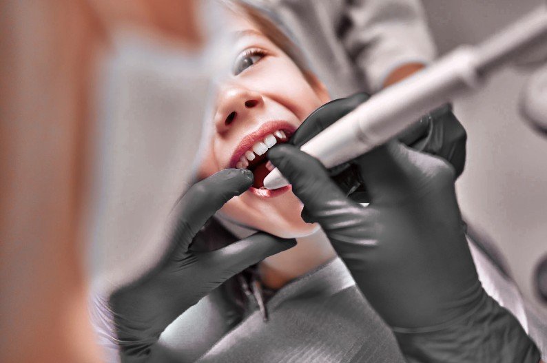 Profilaxis en Medellín - Centro de odontología estética Be Dharma Dental - Clínica Be Dharma