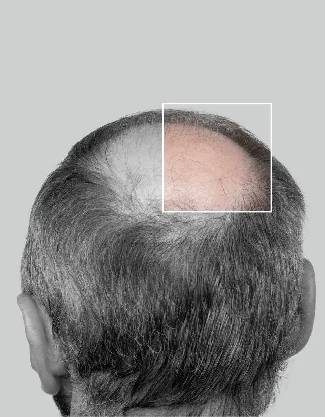 Clínica estética en Medellín-Clínica Be Dharma