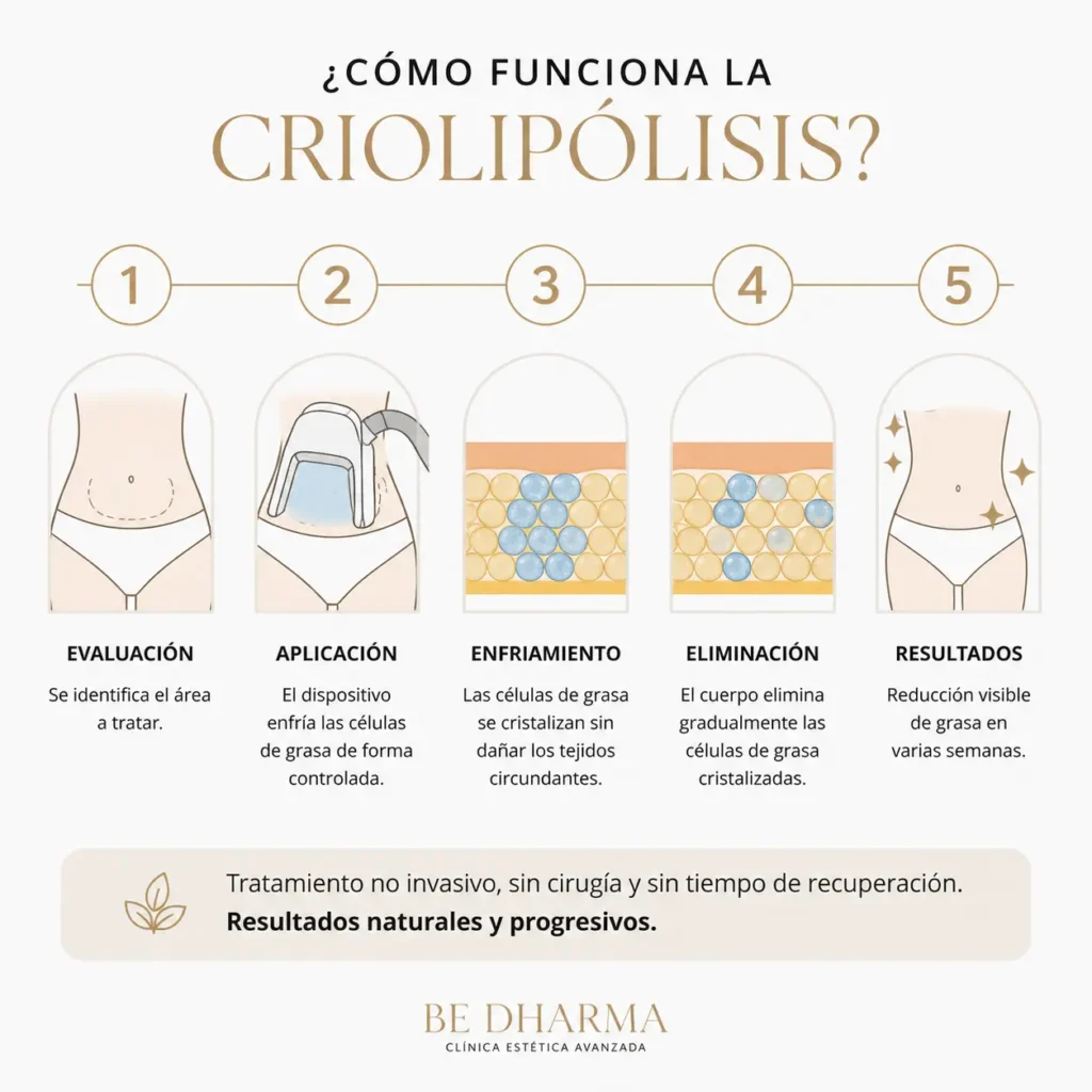 Infografia Cómo Funciona la Criolipólisis