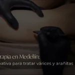 Escleroterapia en Medellín una alternativa para tratar várices y arañitas visibles - Be Dharma