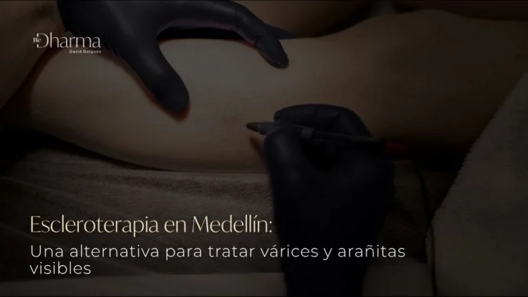 Escleroterapia en Medellín una alternativa para tratar várices y arañitas visibles - Be Dharma