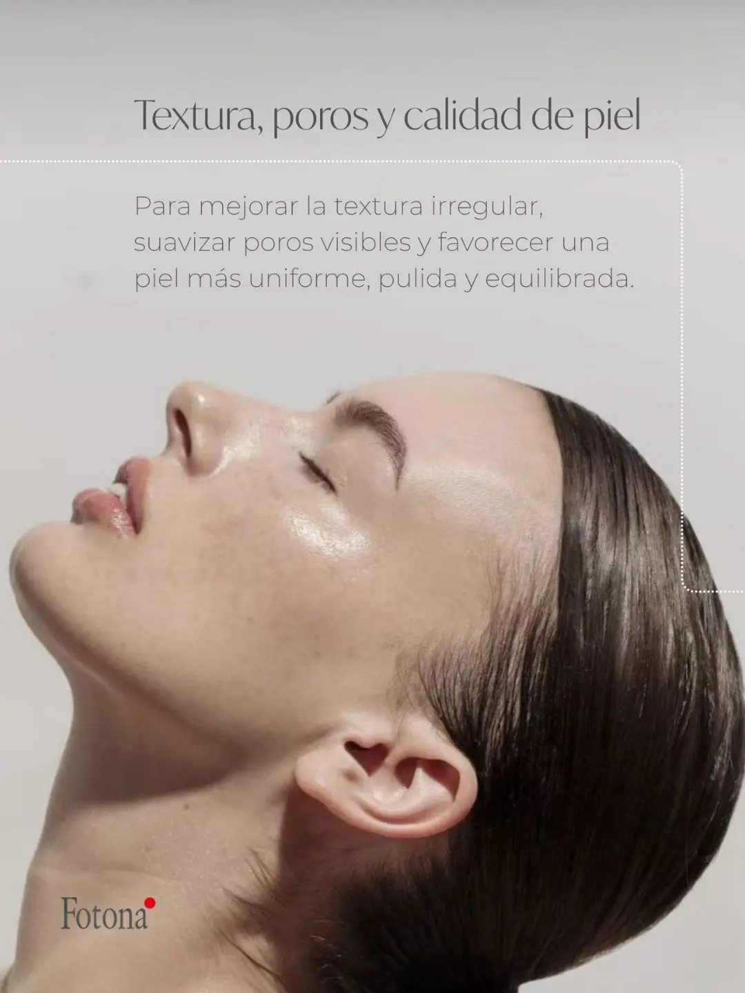 Láser fotona en Medellín - Mejorar textura de la piel - clínica estética Be Dharma