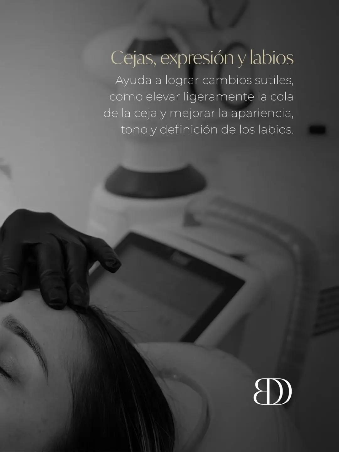 Láser fotona en Medellín - levantamiento de cejas e hidratación de labios - clínica estética Be Dharma