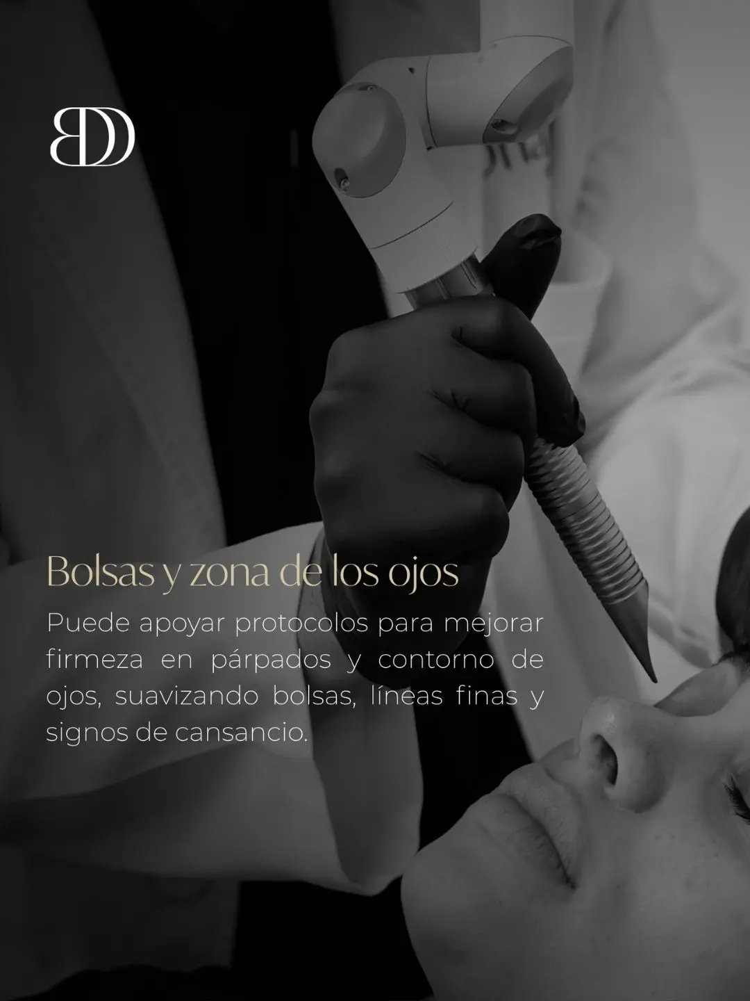 Fotona laser non-surgical eyelid treatment in Medellín at Be Dharma