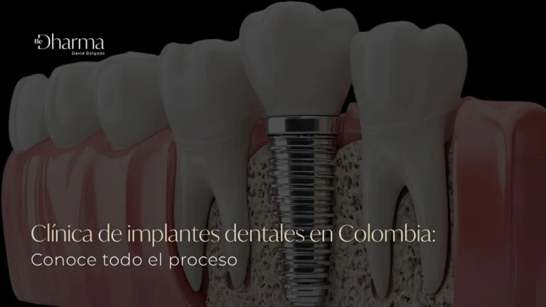 Clínica de implantes dentales en Colombia Conoce todo el proceso - Be Dharma co - MEDELLIN
