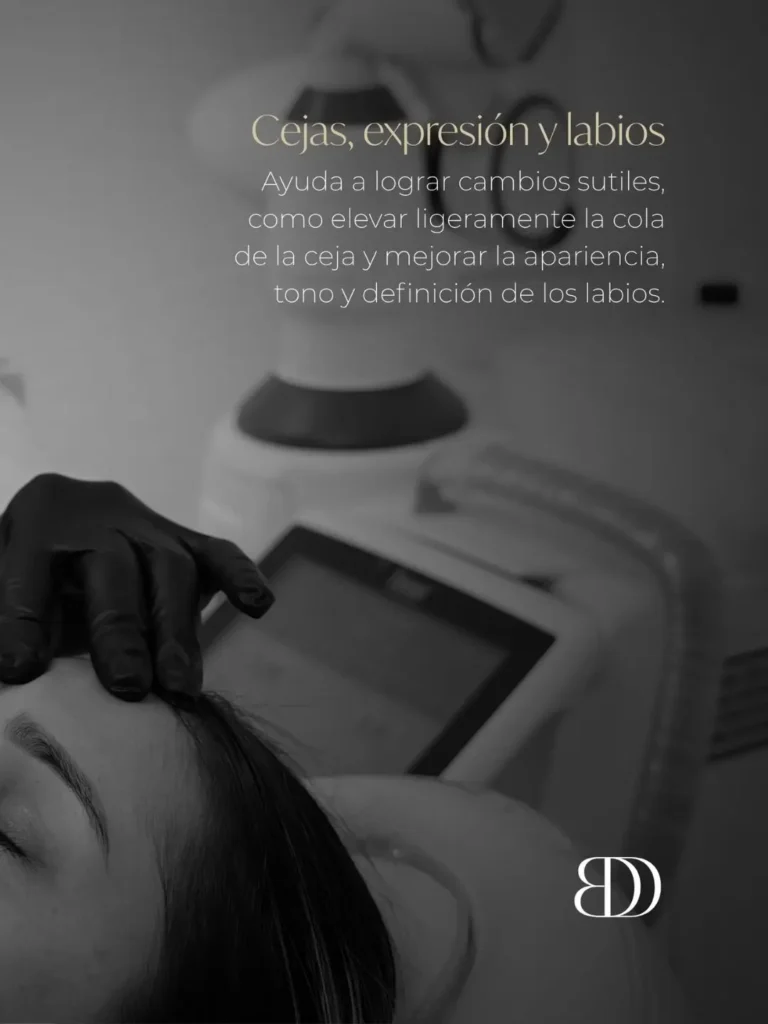 Levantamiento de cejas e hidratación de labios con Fotona