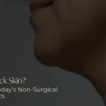 Neck lift non-surgical- Clínica Be Dharma