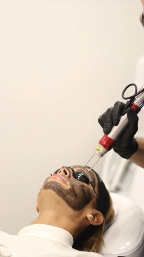 hollywood peel en Medellín - Clínica estética Be Dharma