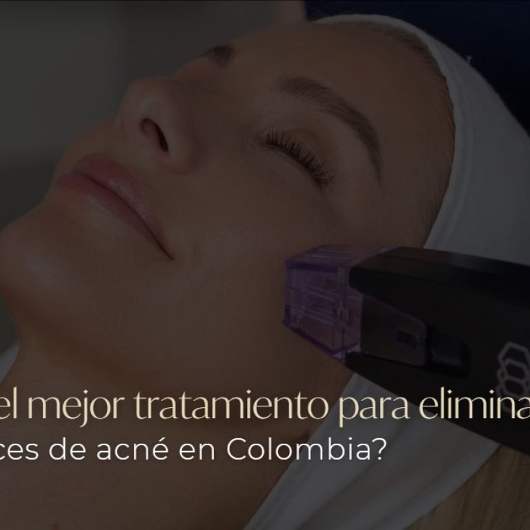 Cicatrices de acné eliminar- Clínica Be Dharma