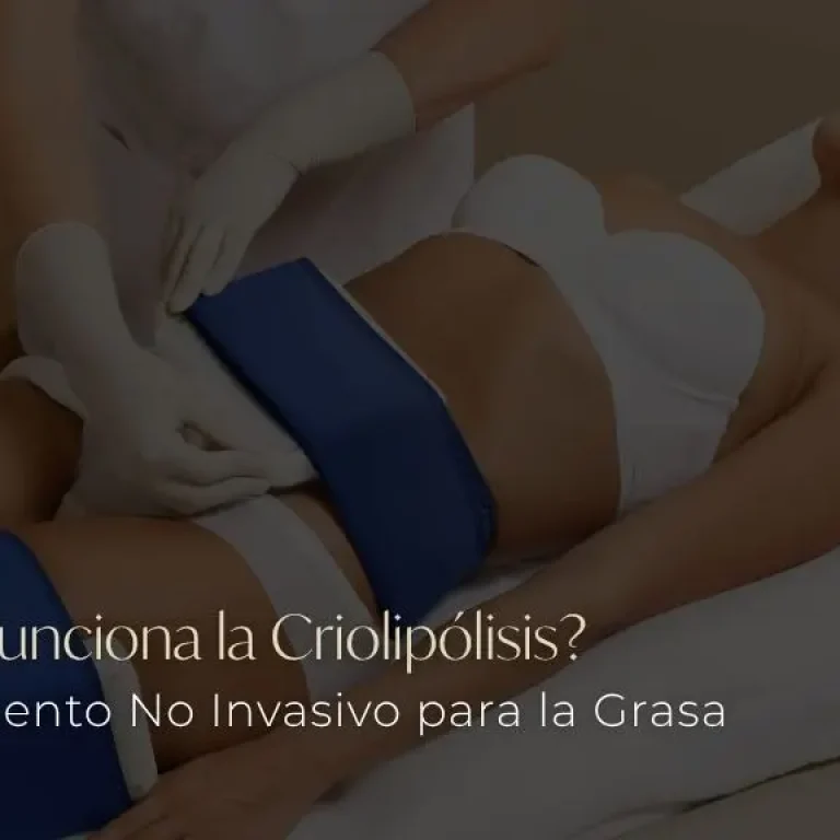 Cómo Funciona la Criolipólisis BE DHARMA