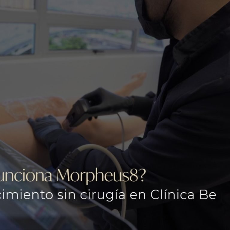¿Cómo funciona Morpheus8?-Clínica Be Dharma