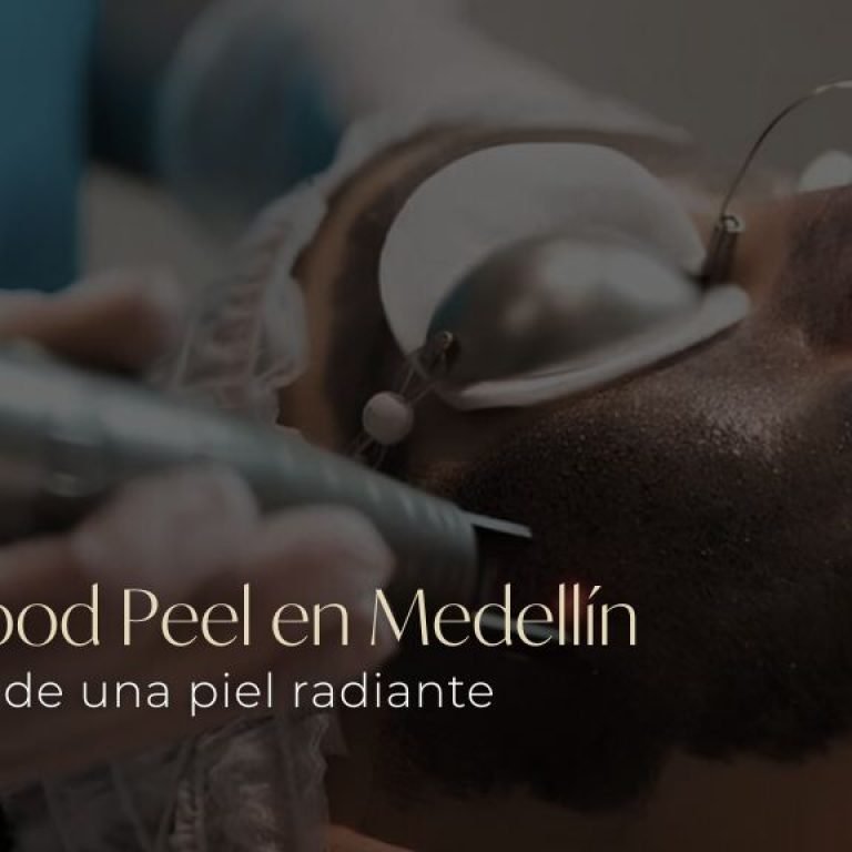 Hollywood Peel en Medellín Renueva tu piel con tecnología de vanguardia